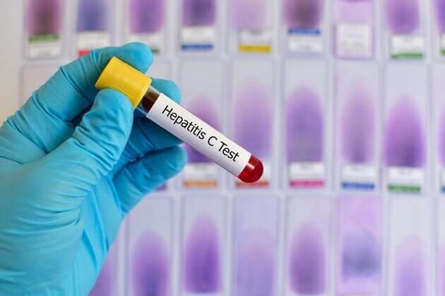 Программа поддержания здоровья при гепатите С (также при гепатитах А и Б) - статьи, MAGERIC