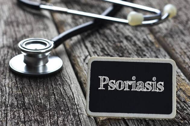 Псориаз — симптомы, препараты для устранения - статьи, MAGERIC