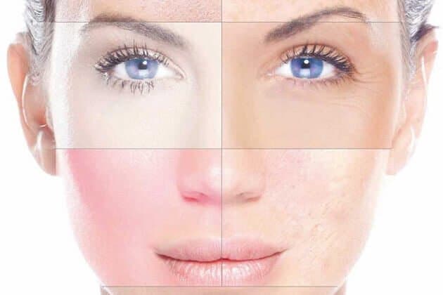 Как определить тип кожи лица?