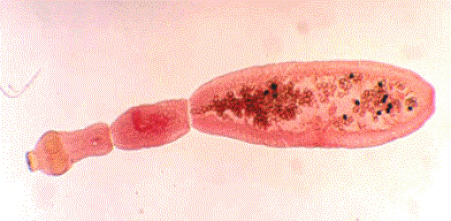 Echinococcus-510x250.gif